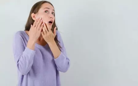 Fakta tentang Jerawat yang Harus Anda Pahami