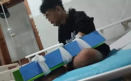 Siswa SMP di Banyuwangi Dianiaya Teman, Alami Retak Tulang Hingga Harus Dioperasi