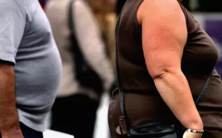 Obesitas Jadi Fenomena Malnutrisi Modern di Seluruh Dunia