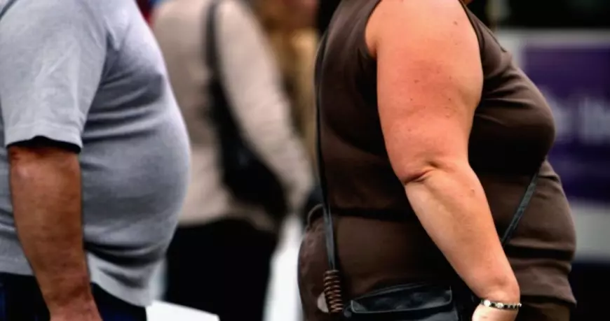 Obesitas Jadi Fenomena Malnutrisi Modern di Seluruh Dunia