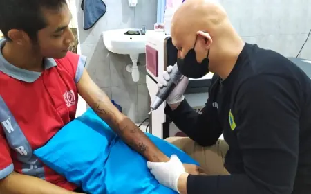Warga Binaan Lapas Kelas IIB Bondowoso Antusias Ikuti Hapus Tato Gratis, Ini Tujuannya