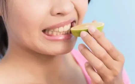 Makanan dan Minuman yang Bisa Bikin Gigi Keropos, Ini Cara Mencegahnya