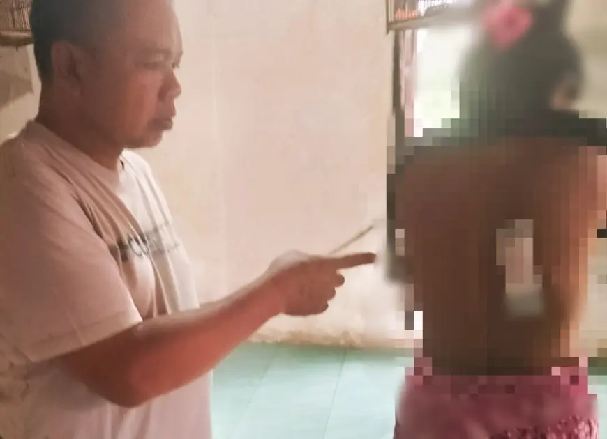Kera Liar di Jember Serang 7 Warga, Jebakan BKSDA Dinilai Kurang Efektif
