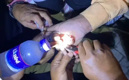 Dokter Angkat Tangan, Petugas Damkar Sampang Evakuasi Cincin dari Jari Balita