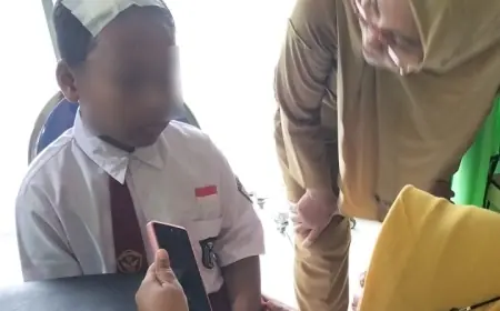 Bocah SD di Mojokerto Dianiaya Ayah Tiri, Kepala Bocor Badan Penuh Luka Bakar