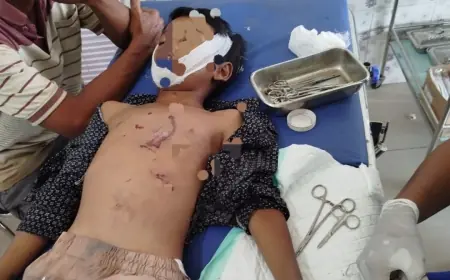 Innalillahi, Bocah 8 Tahun di Nganjuk Tewas Kena Ledakan Petasan