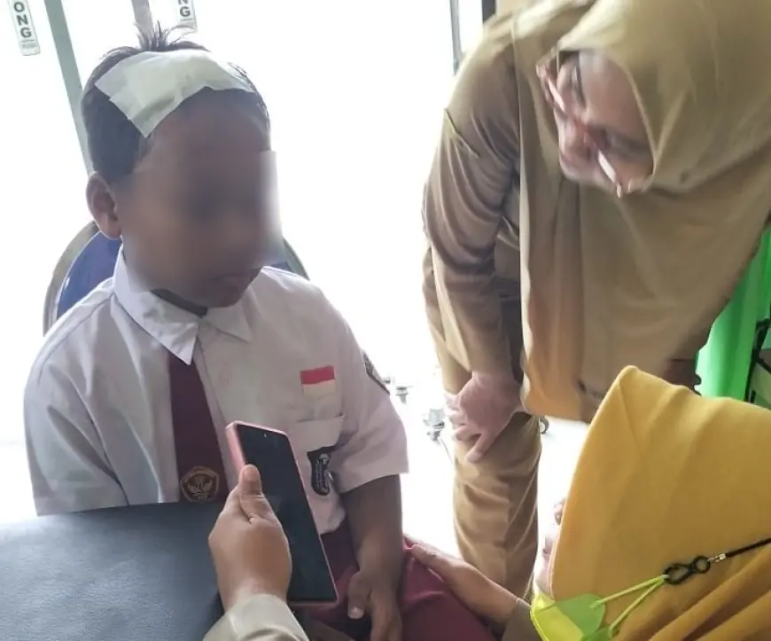 Bocah SD di Mojokerto Dianiaya Ayah Tiri, Kepala Bocor Badan Penuh Luka Bakar