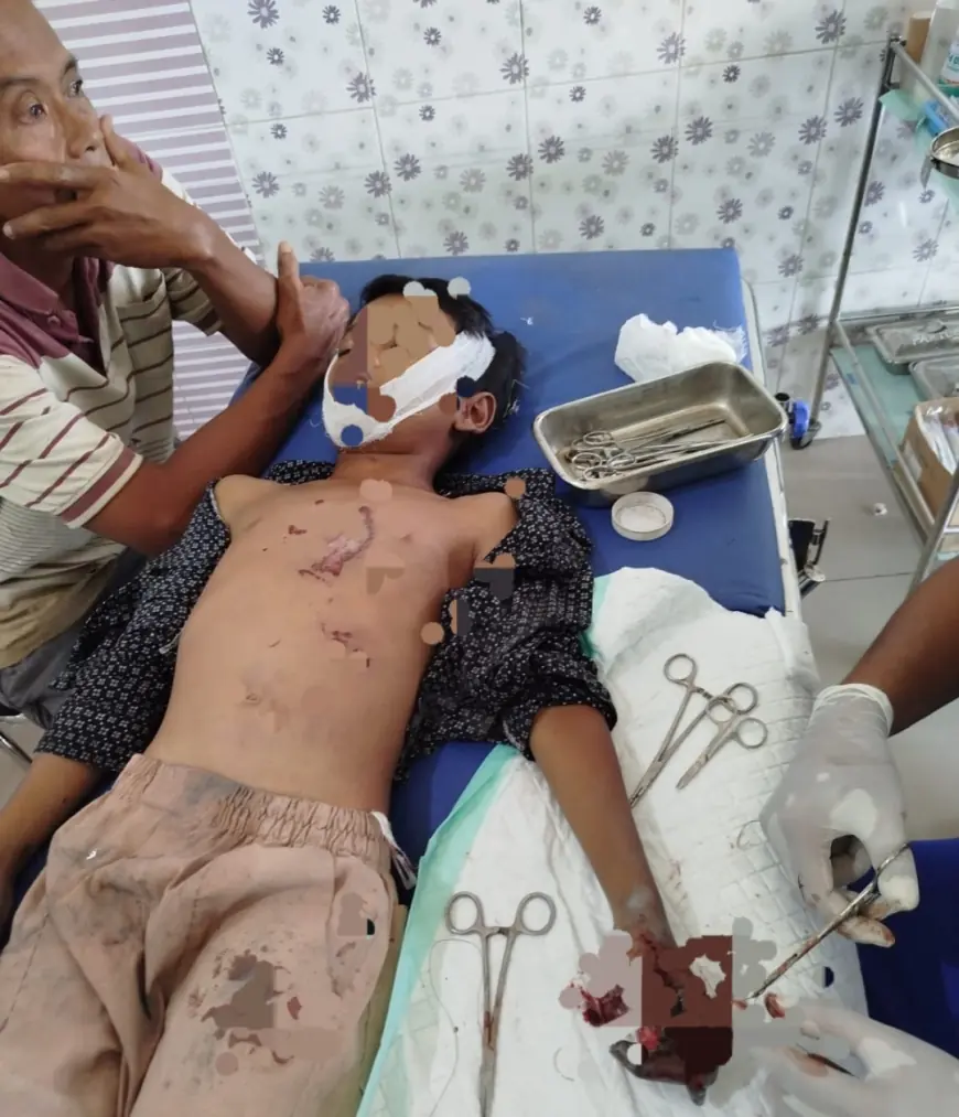 Innalillahi, Bocah 8 Tahun di Nganjuk Tewas Kena Ledakan Petasan