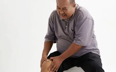 Ini Strategi Efektif Mengatasi Asam Urat