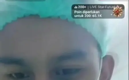 Live TikTok saat Operasi Caesar, Dua Nakes di Jombang Dipecat tidak Hormat
