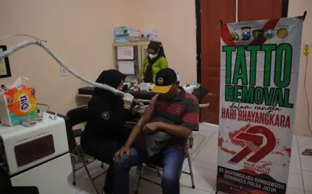 Hari Bhayangkara ke-79, Polres Situbondo Beri Layanan Hapus Tato Gratis