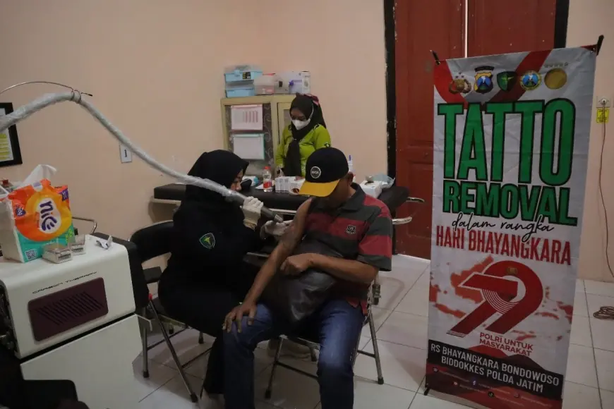 Hari Bhayangkara ke-79, Polres Situbondo Beri Layanan Hapus Tato Gratis