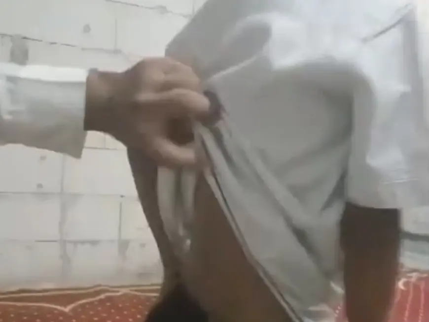 Derita Sakit Kronis dan Gizi Buruk, Bocah di Jombang Butuh Penanganan Medis