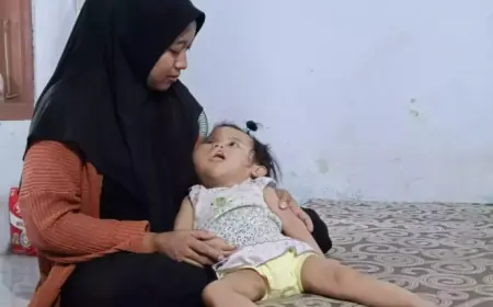 Miris! Balita Probolinggo Sulit Berobat karena Sindrom Proteus Langka