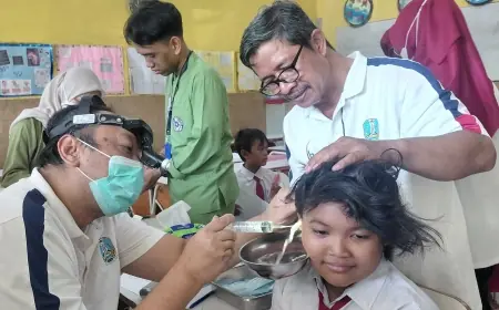 Cotton Bud Bukan Solusi, Dokter Spesialis THT RSUD Haji Ungkap Satu-satunya Cara Aman Bersihkan Telinga