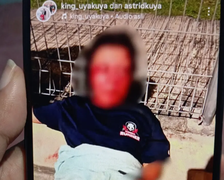 PMI Asal Blitar Dianiaya Sesama WNI di Malaysia, Keluarga Minta Kasus Dikawal Hingga Tuntas