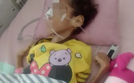 Miris, Balita Gizi Buruk di Nganjuk Baru Terdeksi setelah Satu Tahun Luput dari Pantauan Desa