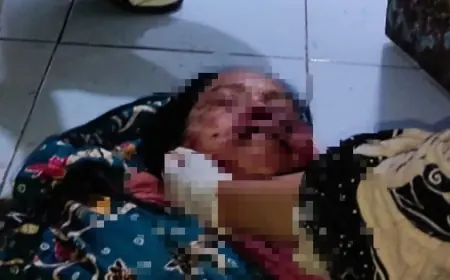 Diduga Depresi, Seorang Anak di Jember Tega Bunuh Ibu Kandung