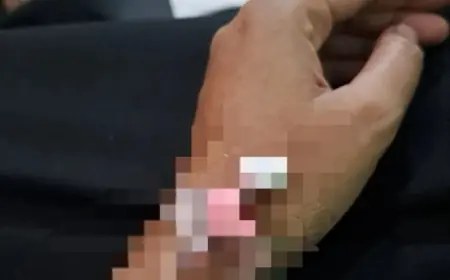 Kasus Dugaan Penganiyaan ASN Dinas PUTR Gresik Mencuat, Kepala Dinas Bungkam