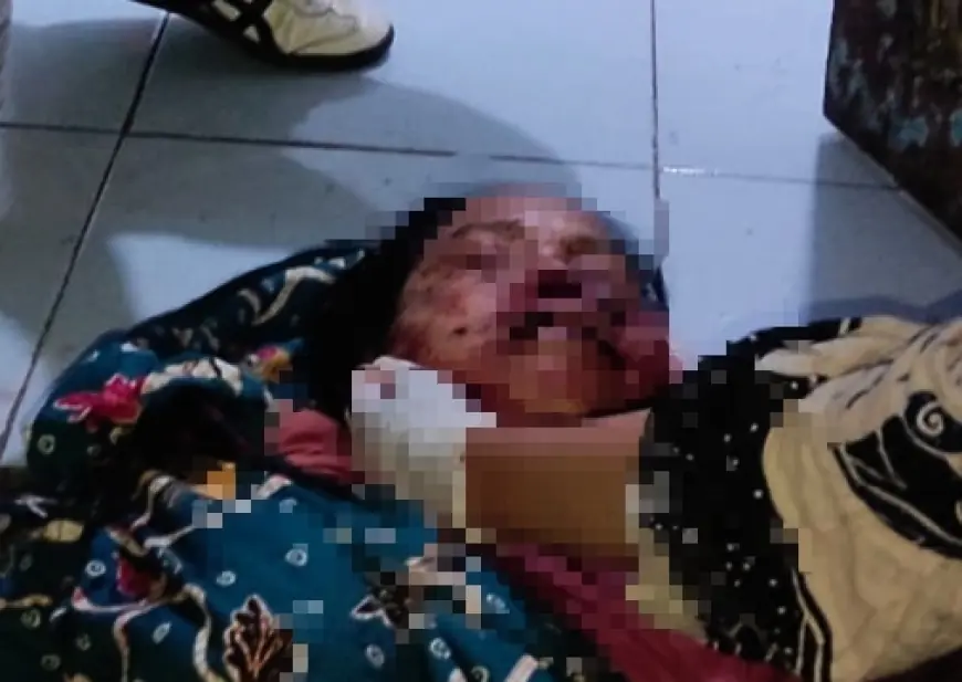 Diduga Depresi, Seorang Anak di Jember Tega Bunuh Ibu Kandung