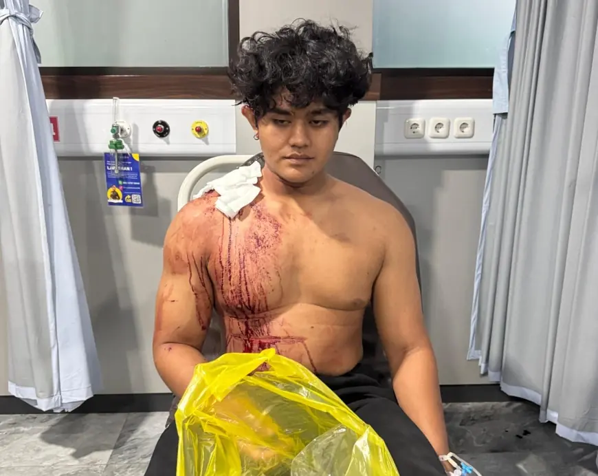 Vokalis Band Underground di Batu Dibacok Saat Tampil, Polisi Buru Pelaku