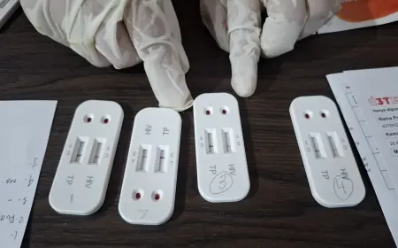 Alarm HIV di Gresik, Kelompok Gay Jadi Faktor Risiko Tertinggi Penularan