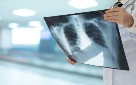 Layanan Pemeriksaan Radiologi di Gresik Bisa Pakai QR-Code