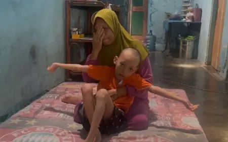 Rawat Bocah Disabilitas dan Ekonomi Sulit, Warga di Jombang Belum Tersentuh Bansos