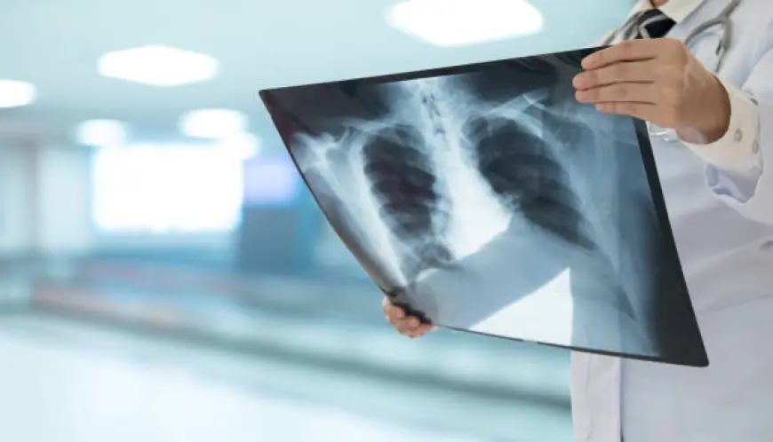 Layanan Pemeriksaan Radiologi di Gresik Bisa Pakai QR-Code