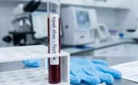 Virus Nipah Kembali Muncul di India, Indonesia Tingkatkan Kewaspadaan