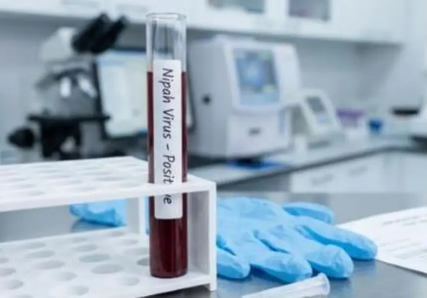 Virus Nipah Kembali Muncul di India, Indonesia Tingkatkan Kewaspadaan