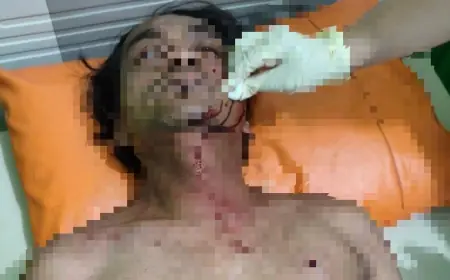 Cekcok Saat Tagih Kompensasi, Warga Prigen Jadi Korban Penembakan Airsoft Gun